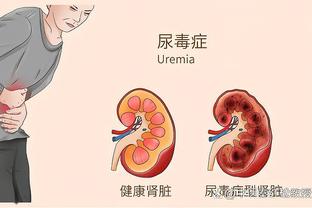 迈克-布朗：福克斯打得很棒 这是他真正的实力